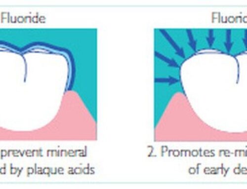 Enamel & Fluoride