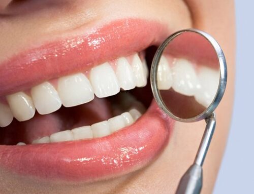 Dental Sealants