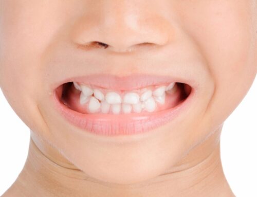 Healthy Teeth for Life